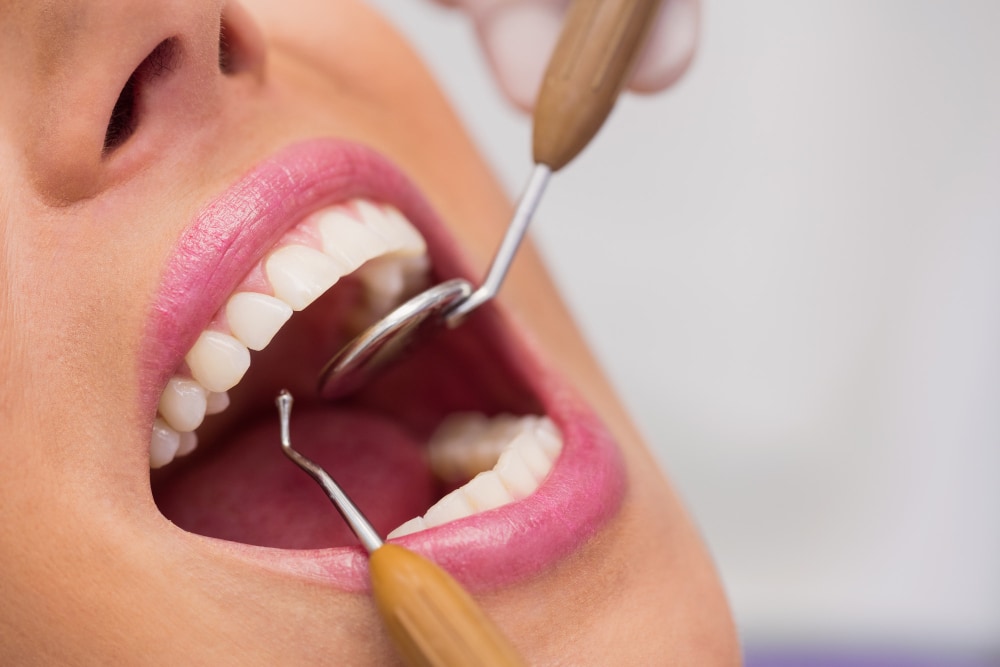teeth-whitening.jpg